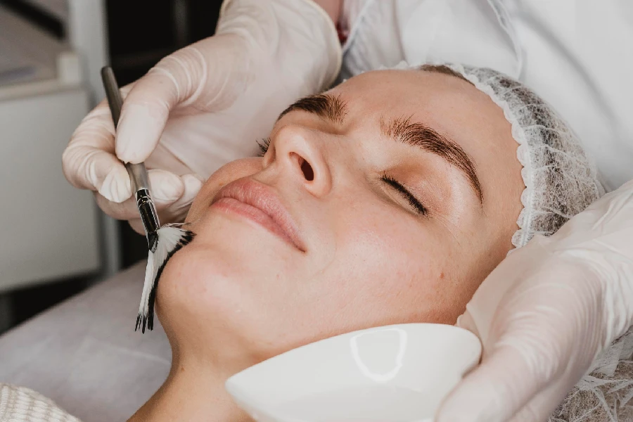 Microdermabrasion and medical chemical peel treatment at SkinKouture