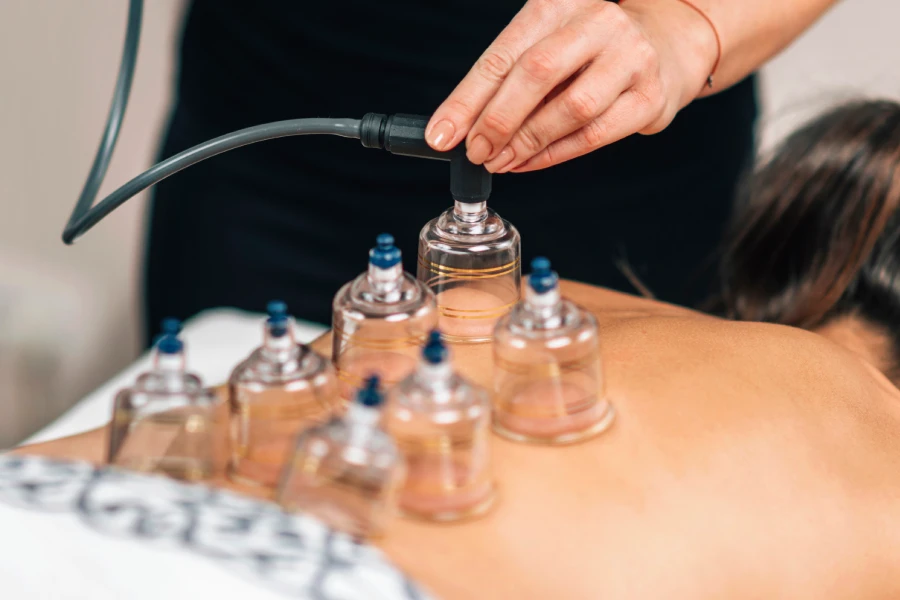 Free cupping therapy consultation at SkinKouture
