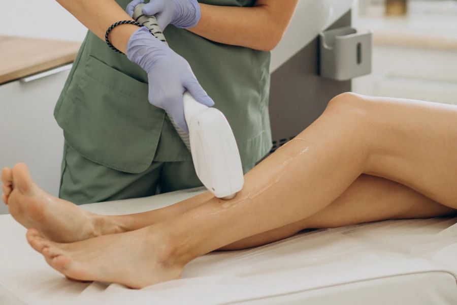 Laser vein removal results at SkinKouture
